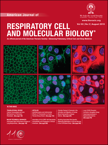 Desai's lab published work in the American Journal of Respiratory Cell and Molecular Biology 